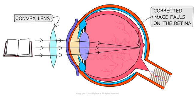 Prescription Eyewear Crafting| SpecSMART Eye Clinic Ikeja