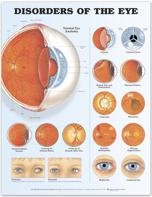 Typical vision issues and preventive measures.