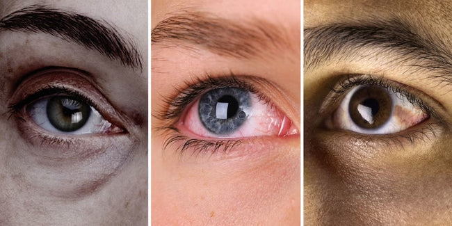 Different Eye Colours