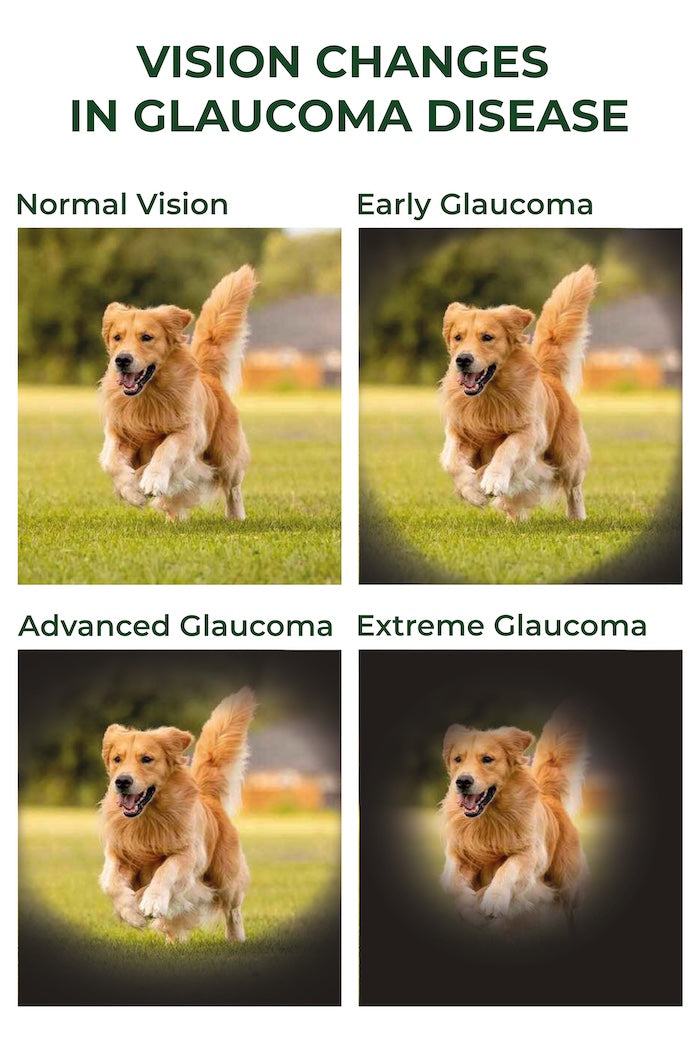 Vision Changes In Glaucoma Disease | SpecSMART Eye Clinic Ikeja