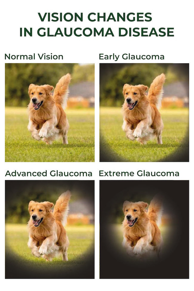 Vision Changes In Glaucoma Disease | SpecSMART Eye Clinic Ikoyi