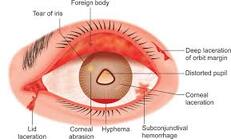 Parts of the eye | SpecSMART Eye Clinic Ikoyi