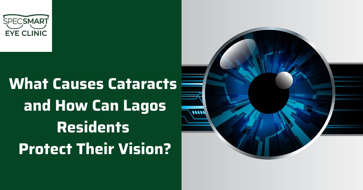 What Causes Cataracts and How Can Lagos Residents Protect Their Vision? A Complete Guide