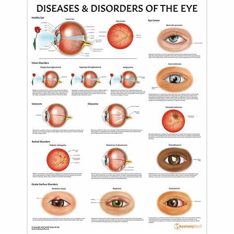 Common Eye Diseases