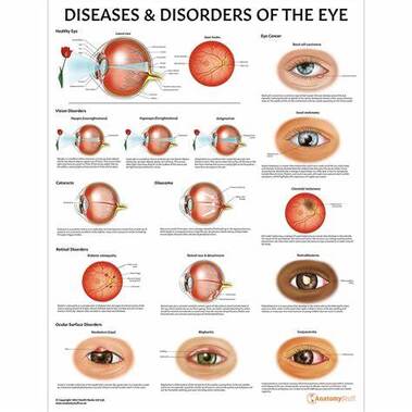 Diseases& Disorders of the Eye| SpecSMART Eye Clinic Ikeja