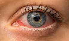 An Eye