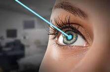 A laser beam targeting the cornea during LASIK eye surgery| SpecSMART Eye Clinic Ikeja