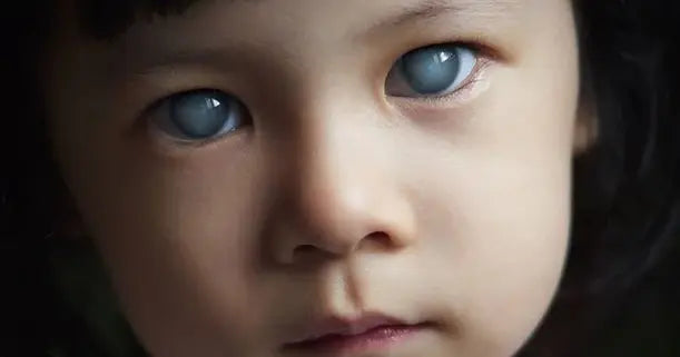 A child with cataract| SpecSMART Eye Clinic Ikeja