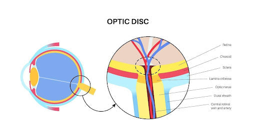 Smoking, Alcohol & Glaucoma | SpecSMART Eye Clinic Ikeja